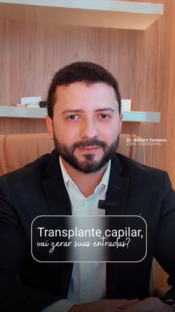 Transplante capilar não é apagar as suas entradas, é saber respeitá-las ✂️

Muita gente acha que faz