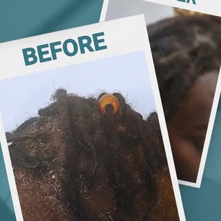 🌟 Hair Loss Solutions for Everyone at Gifted Creations! 🌟

No matter your hair texture or style—wh