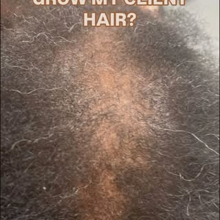 🌟 Fast Results with Gifted Creations Hair Loss Restoration Clinic! 🌟

At Gifted Creations, our per