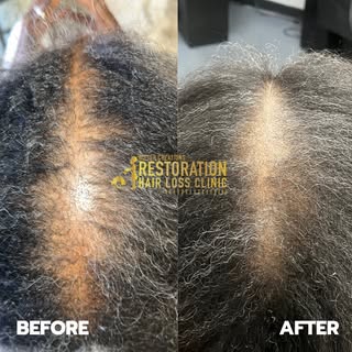 From Thinning to Thriving: Another Incredible Victory at Gifted Creations! 💪

Before: Battling hair