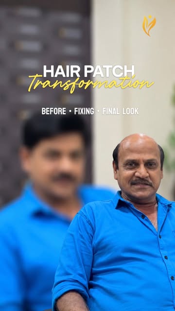 Your hair. Your identity. Your confidence.
At Sparha, every hair patch is meticulously customized to