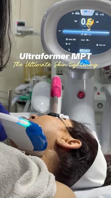 Loose skin doesn’t always need surgery. But it does need the right depth of treatment.

Ultraformer 