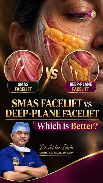 SMAS facelift or deep plane facelift — which is better?

There is no universally “better” technique.