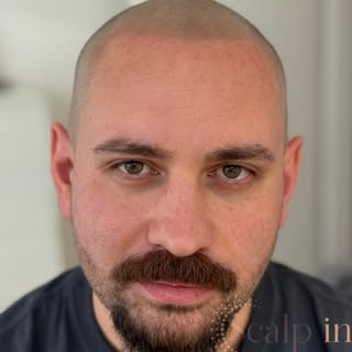 Nicht einfach nur ein neuer Look – sondern ein neues Gefühl im Spiegel. 

Viele Männer kennen diesen