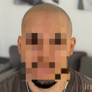 Eine gute Haarpigmentierung erkennt man nicht daran, dass sie auffällt –
sondern daran, wie natürlic