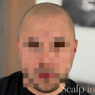 ☀️ Ready für den Sommer – mit einem neuen Look!

Eine Haarpigmentierung lässt lichte Stellen oder ei