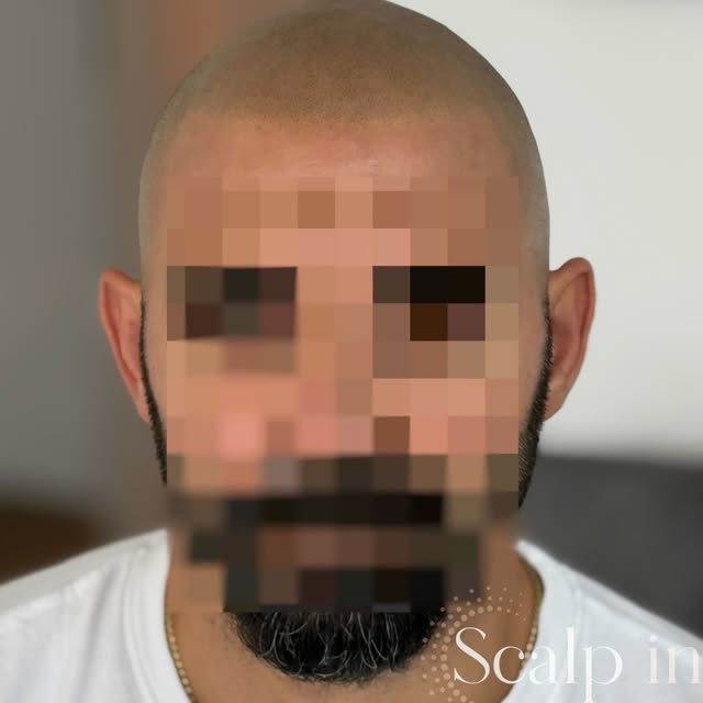 Manchmal reicht schon eine kleine Veränderung, damit man sich selbst wieder ganz anders wahrnimmt.


