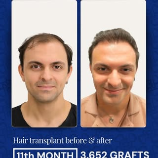 Every transformation starts with the right plan.

Behind this result is more than just a hair transp