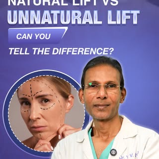 A facelift should make you look refreshed—not “operated on.”

But what makes a facial lift look unna
