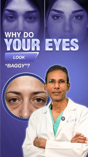 Why do some people develop those persistent “eye bags” under their eyes? 👀
It’s not always just age