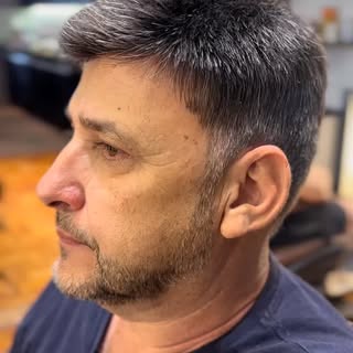 ⭐ Mais do que cabelo, entregamos presença, confiança e identidade.
A prótese capilar masculina certa