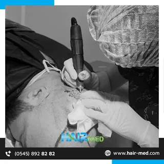 Doğal görünüm, kalıcı sonuçlar👍🏻
Tüm sorularınız için HairMed her şey dahil hizmet ve 7/24 destek 
