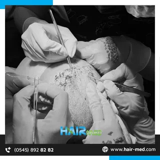 Bırakın saçınız hikayenizi anlatsın 😊
Tüm sorularınız için HairMed her şey dahil hizmet ve 7/24 des