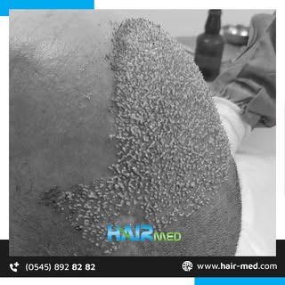 🌟The story of your hair starts all over again here!🌟For all your questions, HairMed is always with