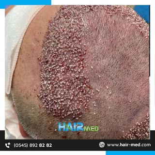 Bırakın saçınız hikayenizi anlatsın 😊
Tüm sorularınız için HairMed her şey dahil hizmet ve 7/24 des