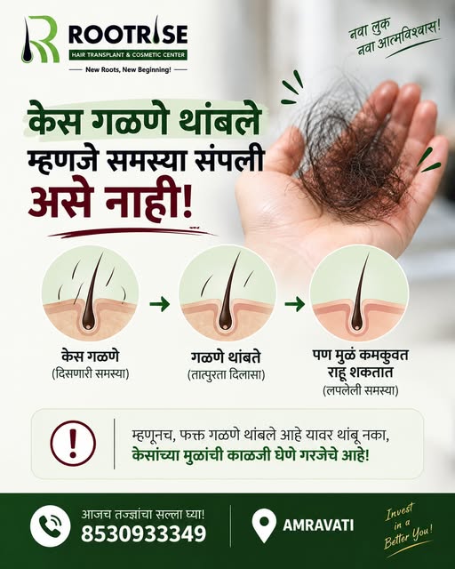 🧑‍🦱 केस गळणे थांबले म्हणजे समस्या संपली असे नाही!

केस गळणे कमी झाले म्हणून लगेच निष्काळजी होऊ नका