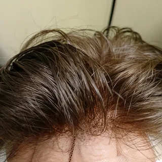 Natural Lace Front

#hairsystem #hairsystems #hairreplacement #manunit #mansystem #nonsurgicalhairre