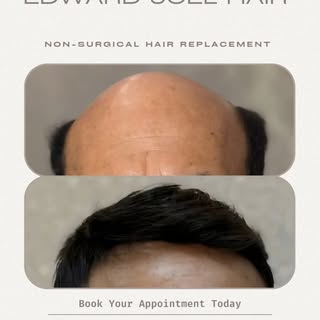 #hairreplacementformen #hairreplacement #hairunit #system #hairsystem 
#michiganhairstylist 
#michig