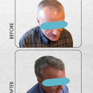 💇 Ένα φυσικό αποτέλεσμα δεν εξαρτάται μόνο από την τεχνική. Ξεκινά από τη σωστή διάγνωση, τον εξατο