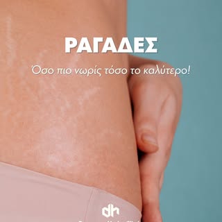 ✨ Οι ραγάδες αντιμετωπίζονται πιο αποτελεσματικά όταν δεν περιμένεις.
Οι ραγάδες δεν εξαφανίζονται α