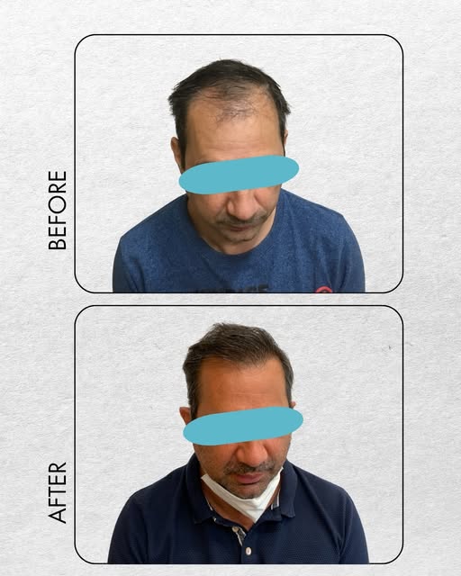 💇 Ένα φυσικό αποτέλεσμα δεν εξαρτάται μόνο από την τεχνική. Ξεκινά από τον σεβασμό στα χαρακτηριστι