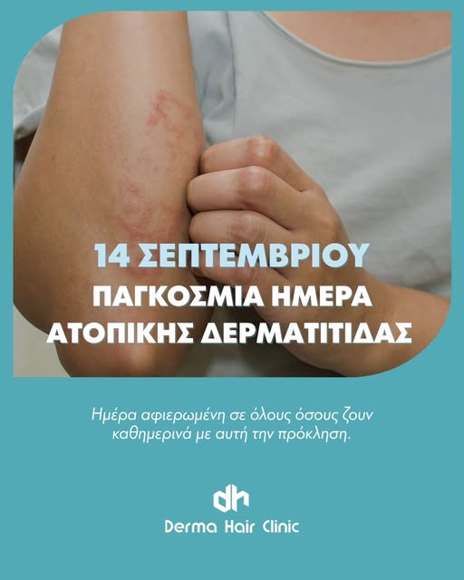 «Δεν είναι “απλώς ξηροδερμία”
Η ατοπική δερματίτιδα είναι μία χρόνια, υποτροπιάζουσα φλεγμονώδης πάθ
