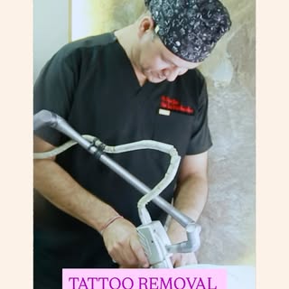 ✨ Your Tattoo Was a Chapter—Not the Whole Story. Start Fresh with Laser Tattoo Removal! 🌿

Whether 