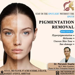 ✨ Don’t Let Pigmentation Hide Your Natural Glow! 🌸

Uneven skin tone, dark spots, melasma, or stubb