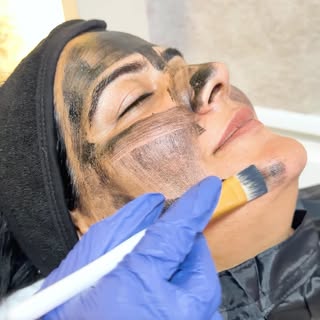 ✨ Deep Cleanse. Instant Glow. Radiant Skin Starts with a Carbon Facial! 🖤

Reveal fresher, smoother