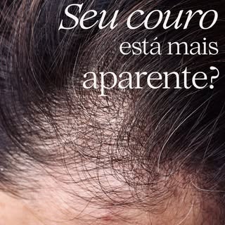 Couro cabeludo mais visível?
Esse pode ser um sinal de alerta e não apenas uma questão estética.

A 