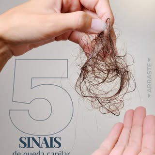 Você acha que está perdendo cabelo demais?
Perder até 100 fios por dia pode ser normal, mas quando a