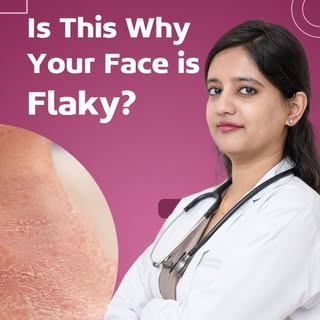 💡 Flaky skin that won’t go away despite using moisturizers? It might not be "dry skin" after all!

