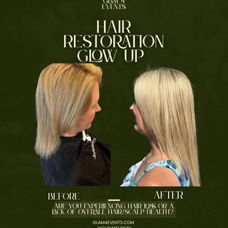 ✨ Hair restoration is personal — and no two journeys are the same. ✨

This beautiful transformation 