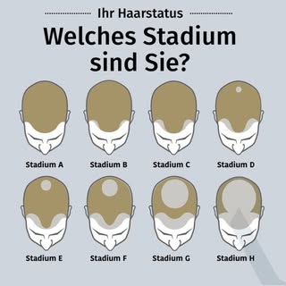 Wie ist Ihr Haarstatus? 

Wussten Sie dass Haare in unterschiedlichen Stadien ausfallen, dass dies a