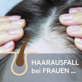 Haarausfall bei Frauen ❔❕

Das so genannte Ludwig-Schema (Bild 2)  unterteilt den androgenetischen H