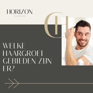 Ontdek de haargroei mogelijkheden bij Horizon Clinics 🌟

Worstel je met kale plekken, inhammen, of 