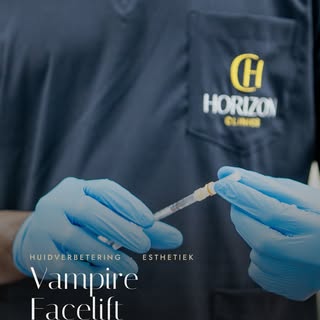 Een natuurlijke boost voor je huid, met je eigen bloedplasma. Dat is de Vampire Facelift. ✨

Klinkt 