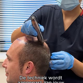 Is een haartransplantatie geschikt voor elk haartype? Een vraag die we vaak horen, dus in deze video