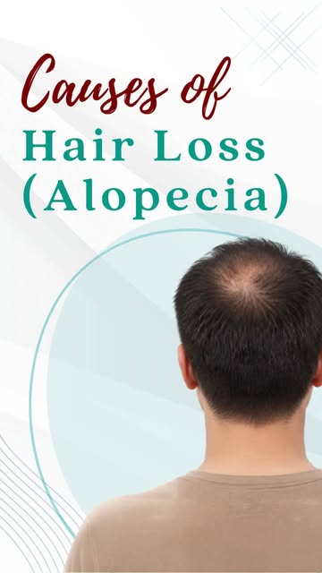 Hair loss (alopecia) can occur due to multiple factors like genetics, hormonal imbalance, stress, nu