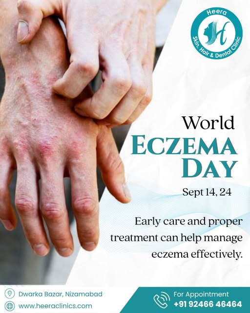 On World Eczema Day, let’s spread awareness and promote better skin care and understanding.

#WorldE