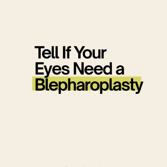 Do your eyes make you look tired even when you are not?
Heavy upper eyelids, excess eyelid skin, und