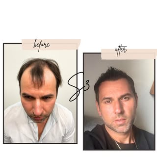 Wow! ONLY 5 months in and already looking amazing🤩 This is just about 45% of the final results! Ima