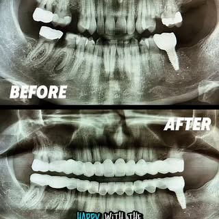Follow me on my trip for dental surgery with @soracamedclinic 
•
#explore #fyp #foryou #dental #surg