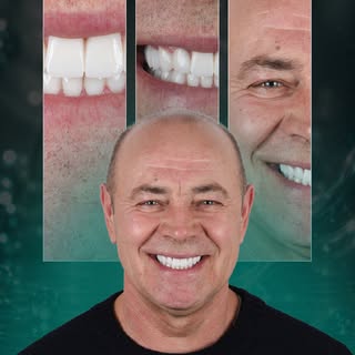 ✨ Another Smile Transformation ✨

Our patient Andrii Timashov completed his dental treatment with us