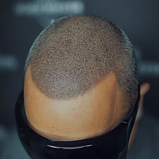 Scalp Master uses our industry expertise and knowledge to deliver the best possible results for ever