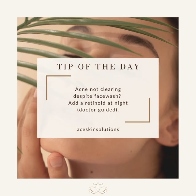 #acneproneskin #acnecontrol #pores #tuesdaytip #aceskinsolutions