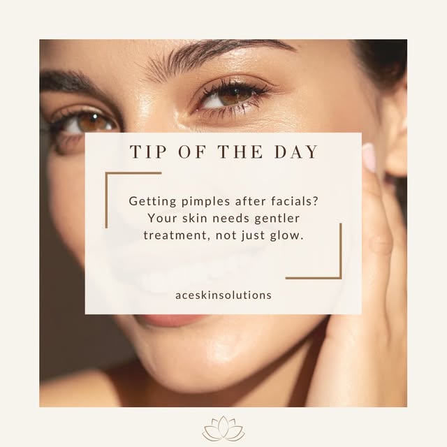 #pimples #acneproneskin #tuesdaytips #cloggedpores #aceskinsolutions