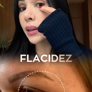 Nem todo excesso de pele nas pálpebras precisa começar com cirurgia. ✨

A blefaroplastia química é u