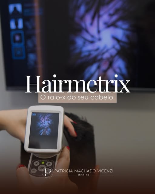 Chega de gastar com produtos que não funcionam para o seu tipo de queda. 
Vamos descobrir o que o se