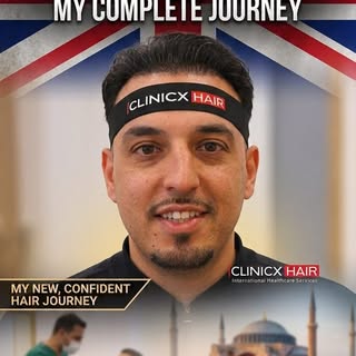 Bradford ➡️ Clinicx Hair for round two! 🇬🇧✨ Thrilled to welcome back our UK patient for a second s
